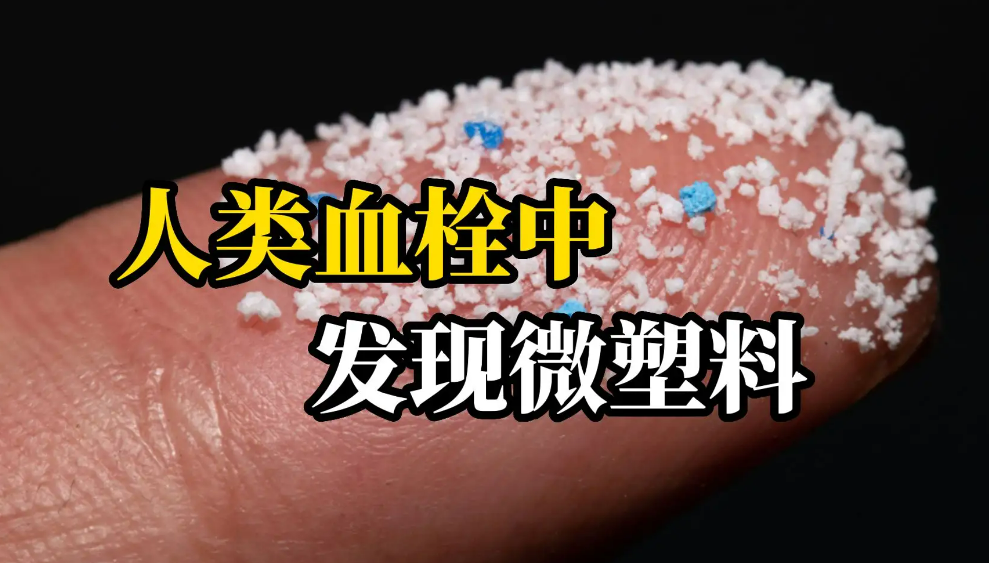 震驚！人類血栓中首次發(fā)現(xiàn)微塑料！